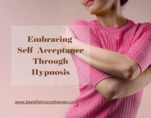 Los-Angeles-hypnosis-can-help-you-achieve-self-acceptance-website